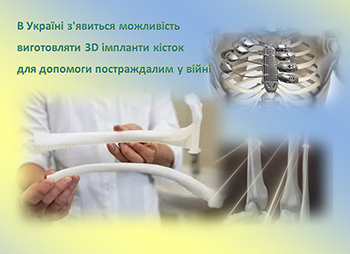 В Україні з’явиться можливість виготовляти 3D імпланти кісток для допомоги постраждалим у війні