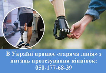 В Україні працює «гаряча лінія» з питань протезування кінцівок: 050-177-68-39