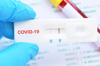 На Чернігівщину доставлено понад 7 тисяч антиген-тестів для визначення COVID-19